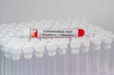 非洲豬瘟病毒熒光PCR核酸檢測試劑盒圖3 非洲豬瘟病毒熒光PCR核酸檢測試劑盒圖3